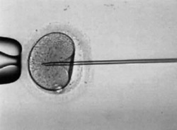 sperm injection into ovum